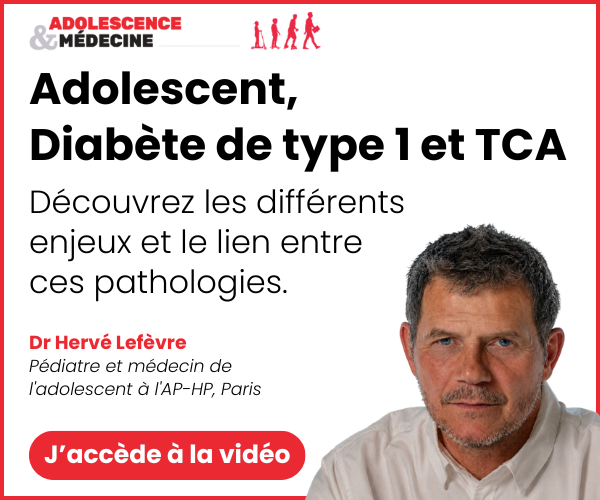 topo dt1 et tca